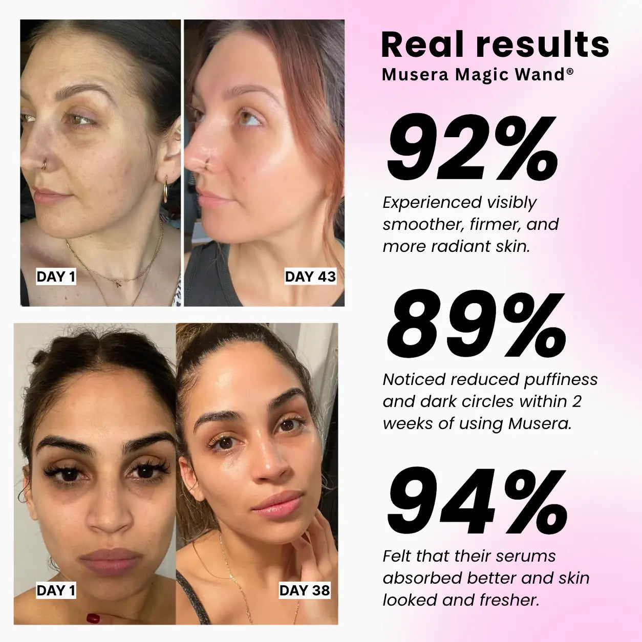 Before and after using Red Light Therapy Wand showing firmer, radiant skin