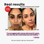 Hyaluronic Acid Serum